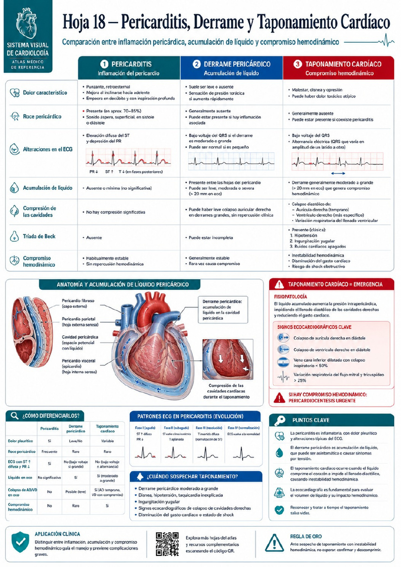 Tromboembolismo Pulmonar